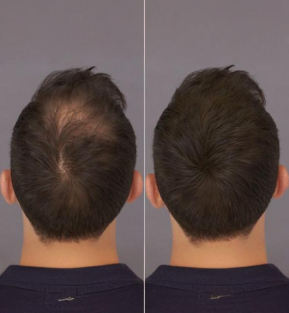 Before After 3 (2)