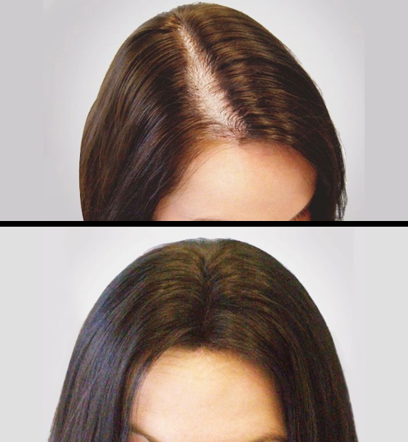Before After 6 (1)